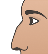 Crooked Nose