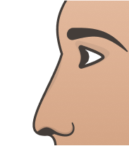 Flat Nose