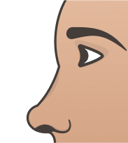 Snub (Small) Nose