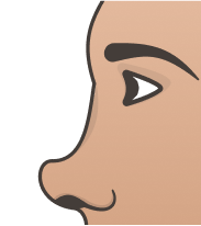 Turned-up Nose